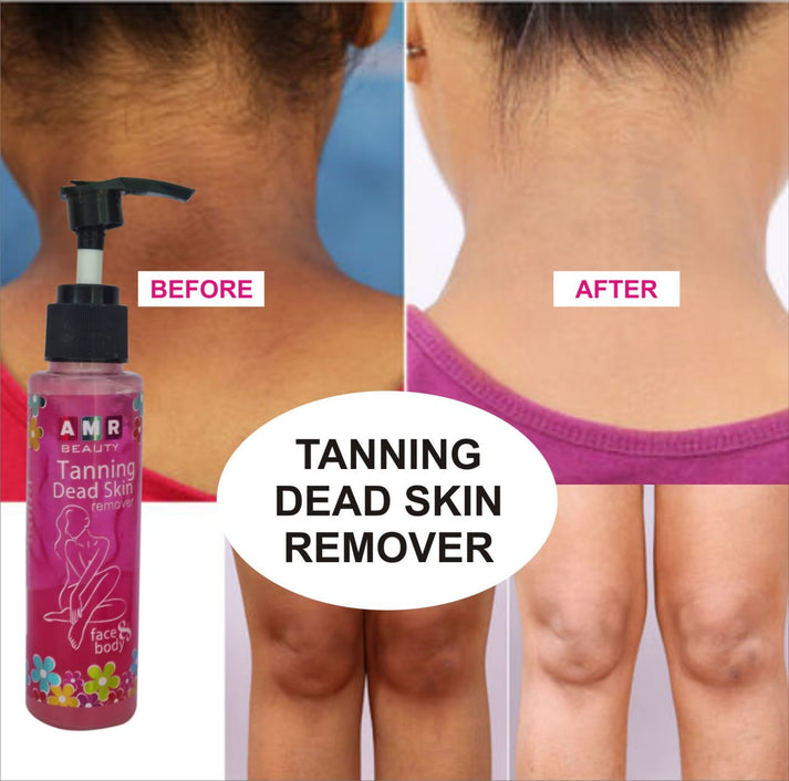 Dead Skin Remover | 🔥FLAT 50% OFF SALE🔥