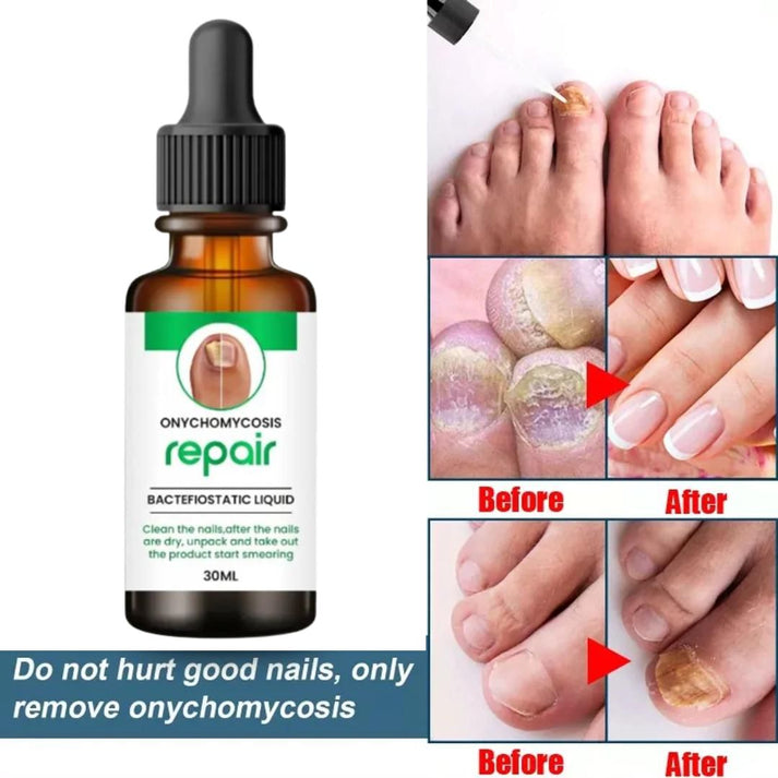 Complete Nail Protection Nail Serum