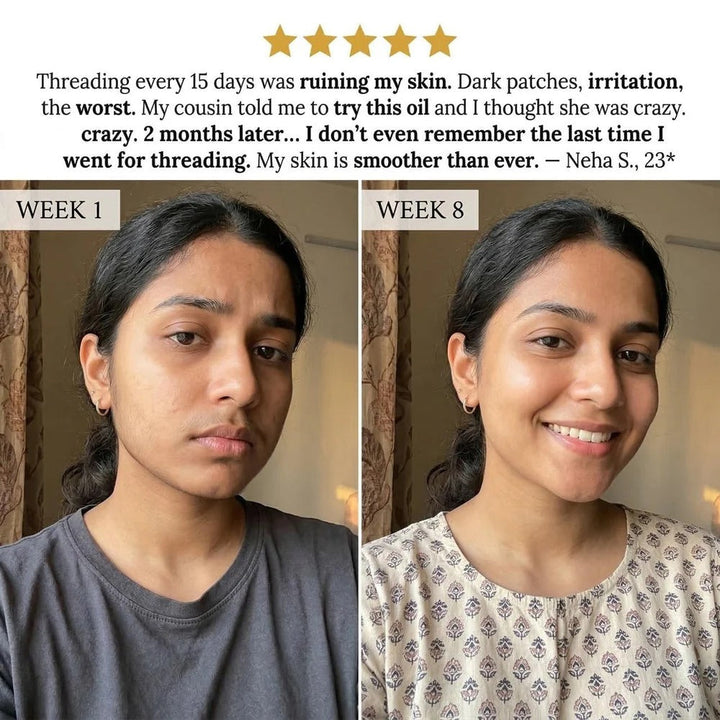 Layali Follicle Rotundus Oil for Hair Removal |🔥Buy 1 Get 1 Free🔥