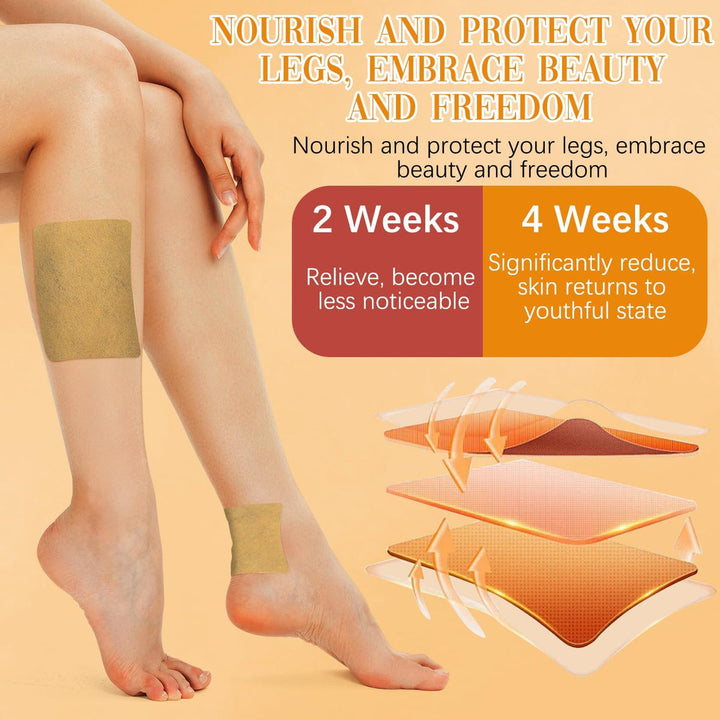 VeinEase™ -Turmeric Varicose Vein Patches | 🔥BUY 1 GET 1 FREE🔥