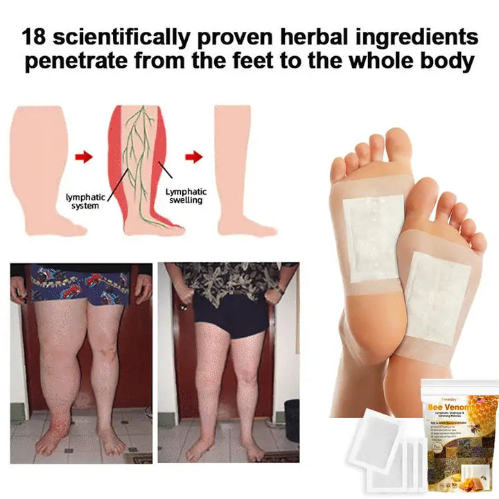 Bee Venom Lymphatic Drainage &amp; Slimming Foot Patches | 🔥Buy 1 Get 1 Free🔥